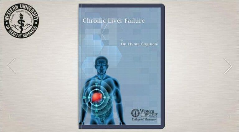 Digital textbook titled "Chronic Liver Failure" by Dr. Hyma Gogineni, displayed on a screen with a visual of a human torso and liver. The book cover includes the Western University College of Pharmacy logo.