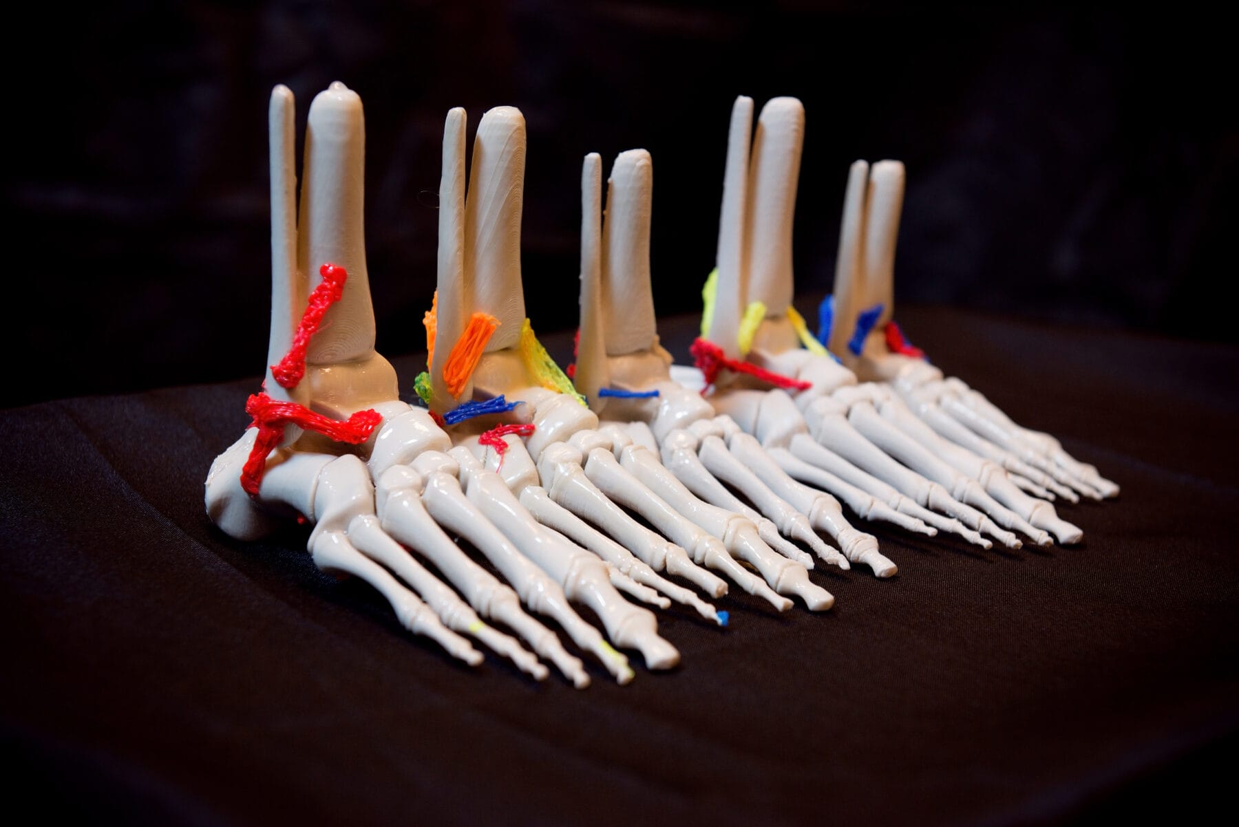 Seven anatomical foot models displayed in a row, each showing bones and ligaments with different colored markers, against a dark background.