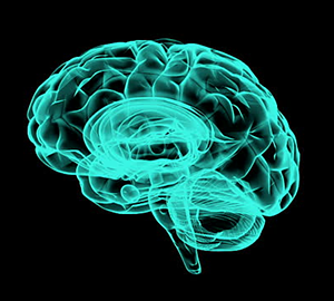 x-ray Brain x-ray image of a brain